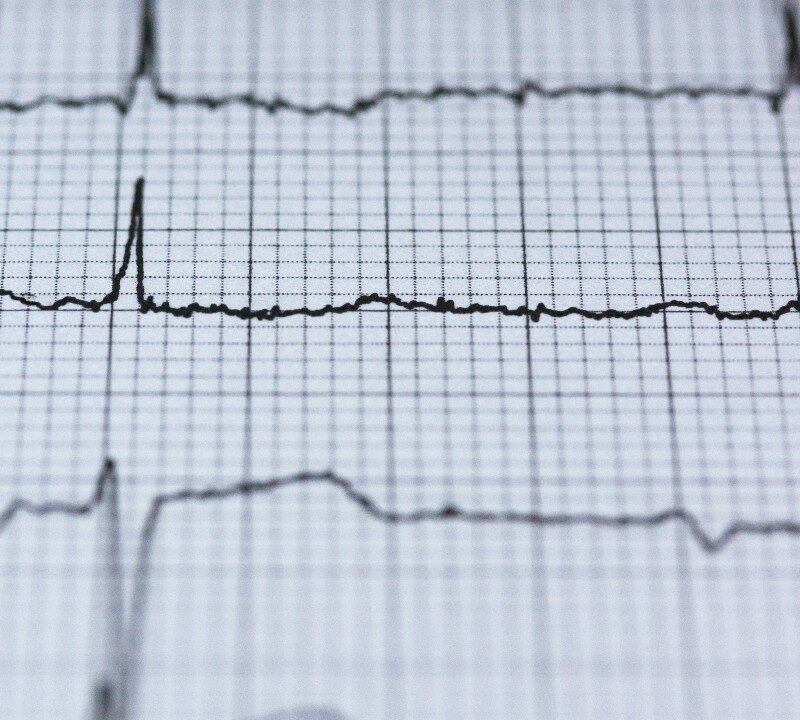 Reducing the Risk of Heart Attacks and Strokes