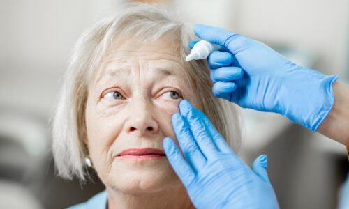 Age-Related Eye Disease