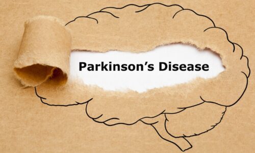 New Procedure to Help Parkinson’s Patients