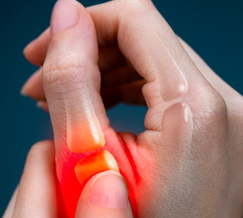 The Agony of Thumb Pain