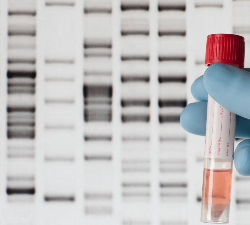 How Genomic Testing Helps Battle Cancer