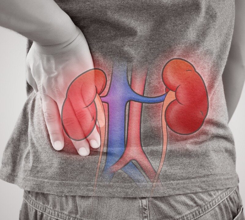 Living Longer After a Kidney Transplant