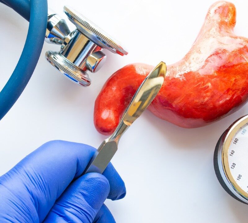 Weight Loss Surgery Helps Battle Liver Disease