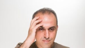 Help for Male Pattern Baldness