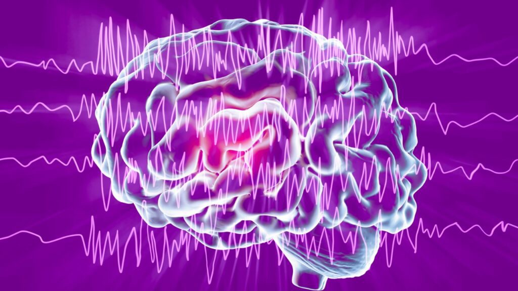 A New Way to Treat Epilepsy