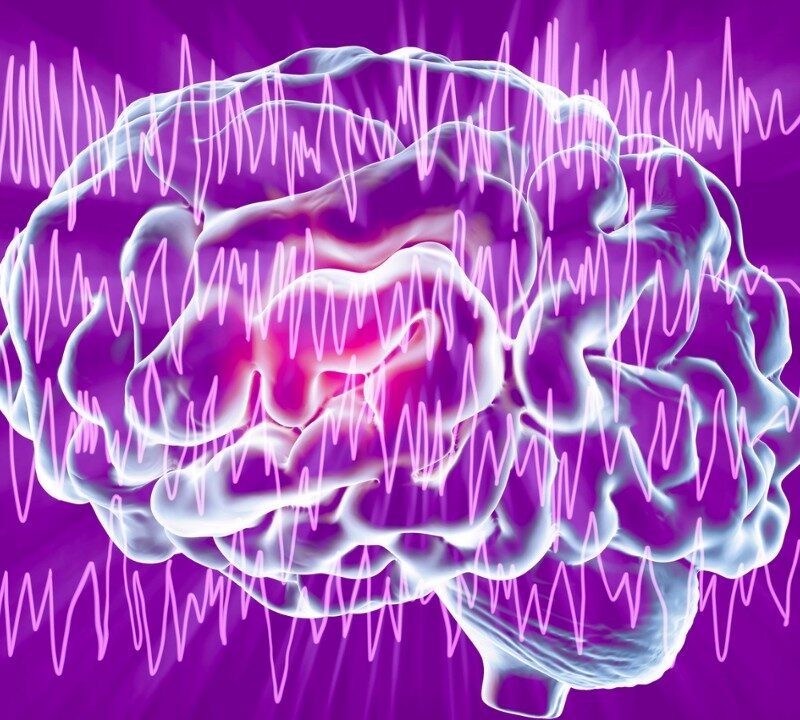 A New Way to Treat Epilepsy