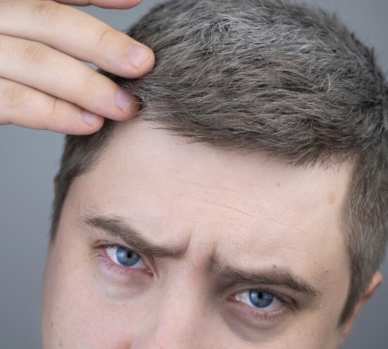 Stress and Gray Hair
