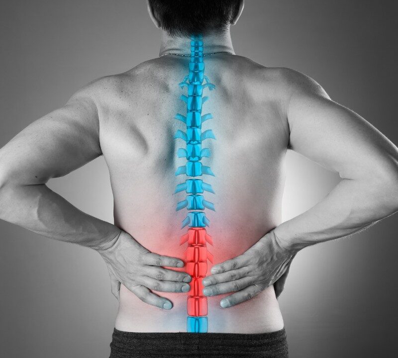 Treating Sciatica: A Very Common Back Pain Condition