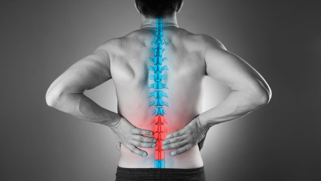 Treating Sciatica: A Very Common Back Pain Condition