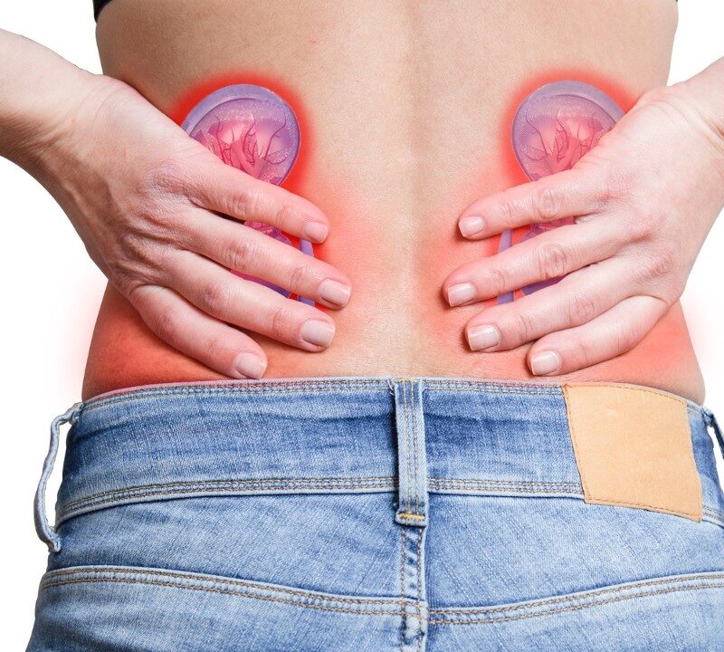 Lowering the Risk for Kidney Stones Through Diet Changes