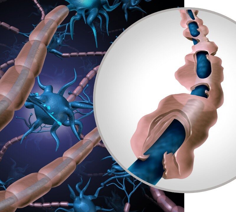 COVID Vaccines for People with Multiple Sclerosis