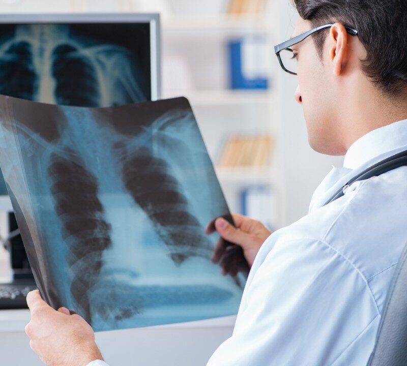 Catching Lung Cancer Early