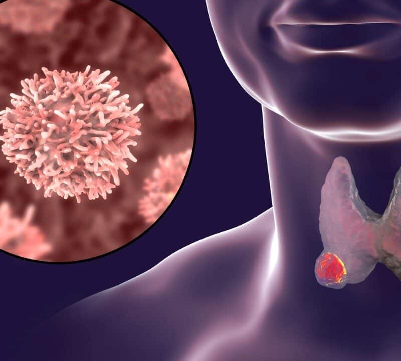 Improved Treatments for Neck and Head Cancers