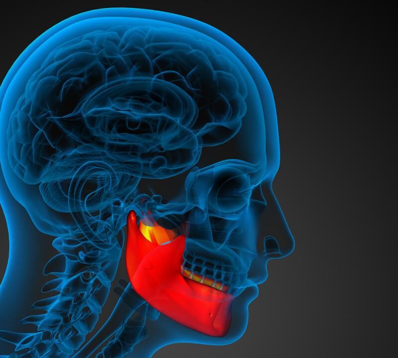 Reconstructing a Damaged Jaw