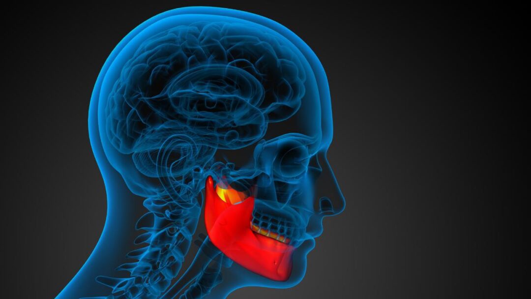 Reconstructing a Damaged Jaw