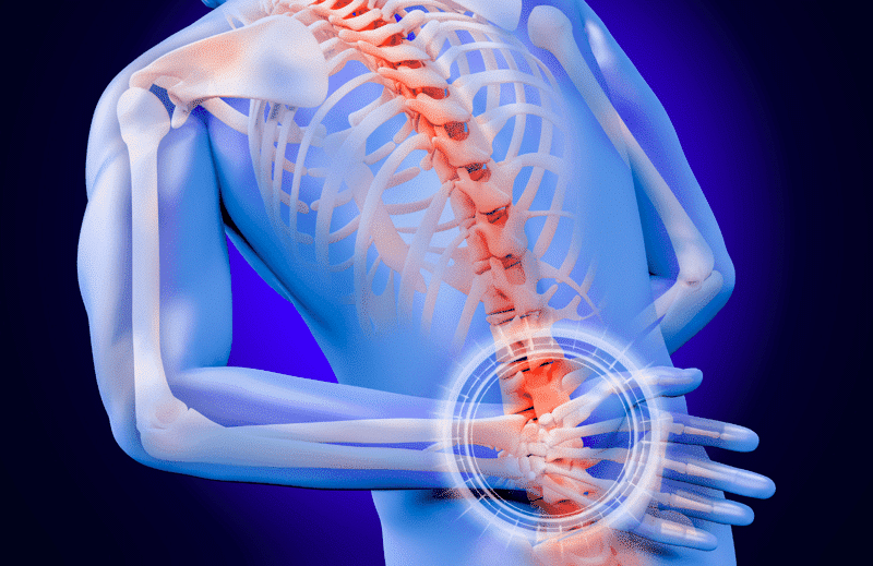 How Steroids Can Be Used to Ease Persistent Back Pain | Health Channel