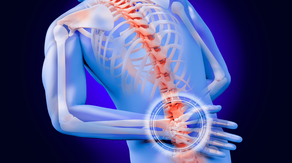 How Steroids Can Be Used to Ease Persistent Back Pain | Health Channel