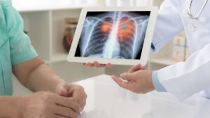 Should You Be Screened for Lung Cancer?