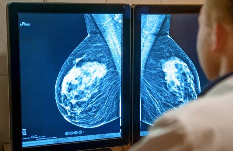 Different Types of Breast Cancer | Health Channel