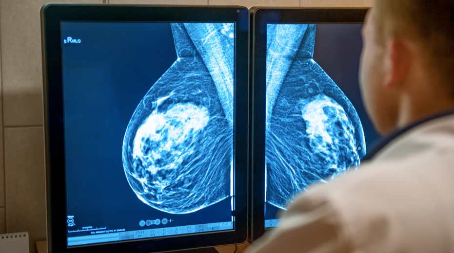 Different Types of Breast Cancer | Health Channel