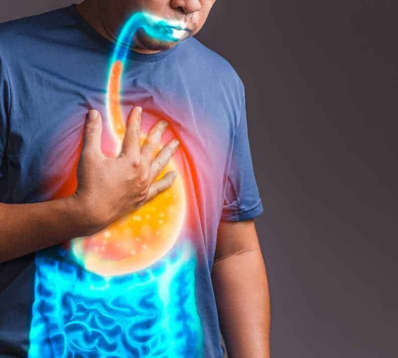 What is GERD?