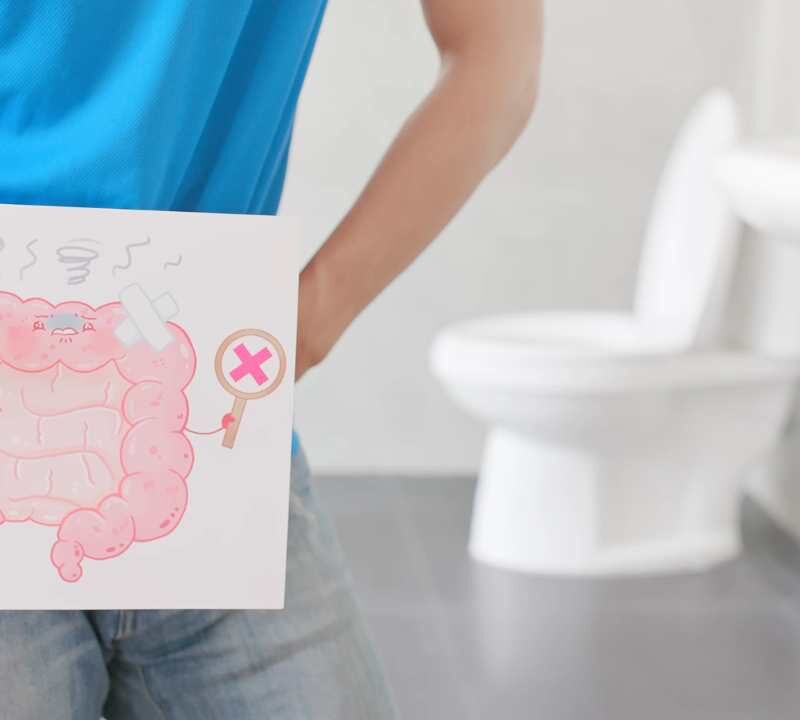 How Often Should You Get a Colorectal Cancer Screening?
