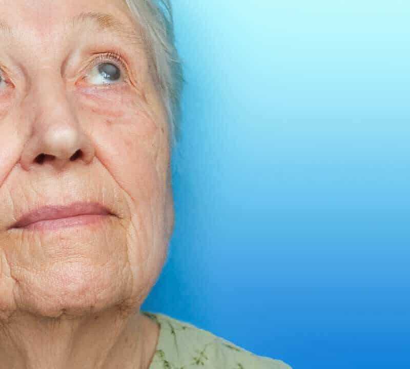 TRUE or FALSE: Glaucoma Only Affects the Elderly