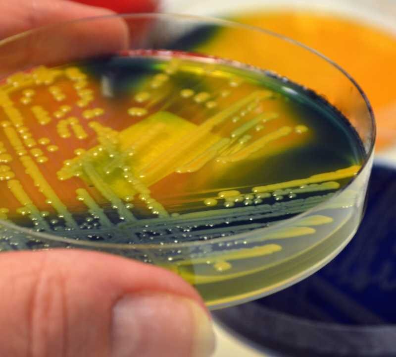 What Are Superbugs?