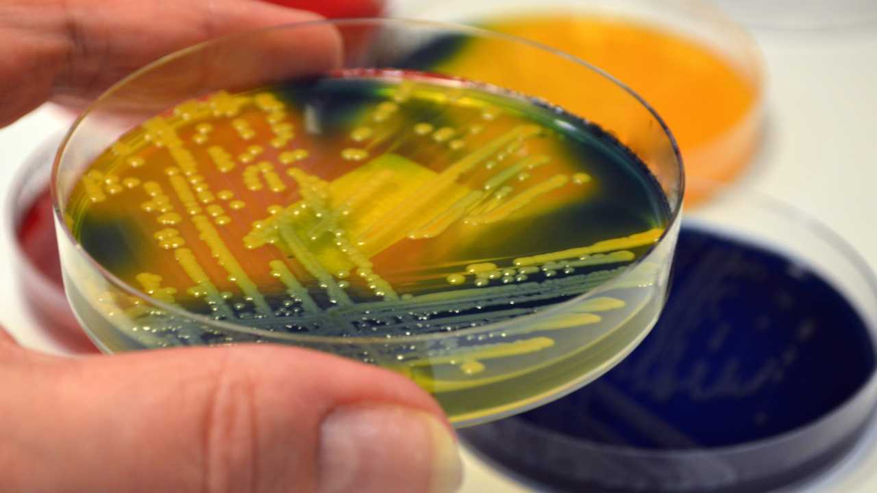 What Are Superbugs?