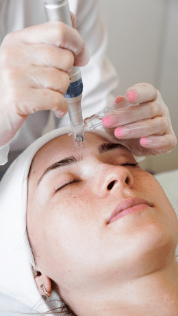 Microneedling, Botox, & Blue Light Therapy