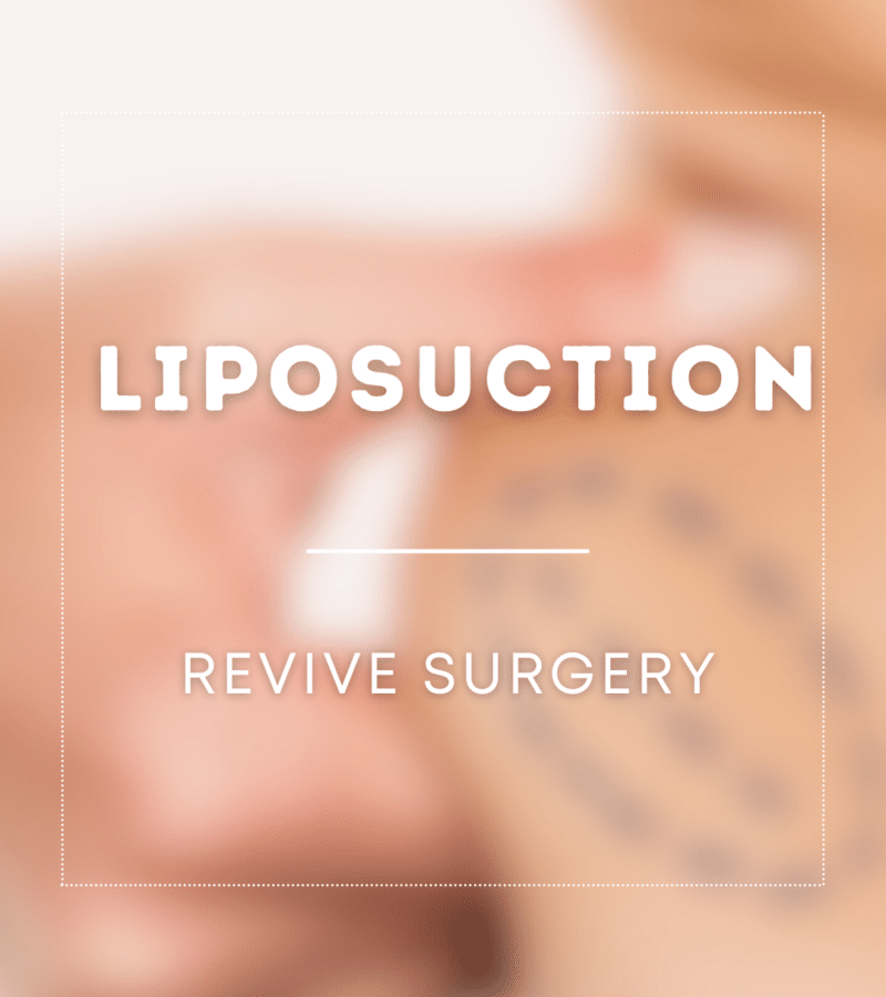 Liposuction