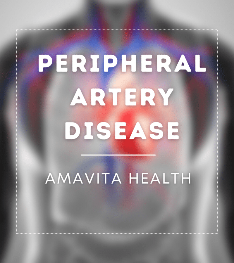 Peripheral Artery Disease