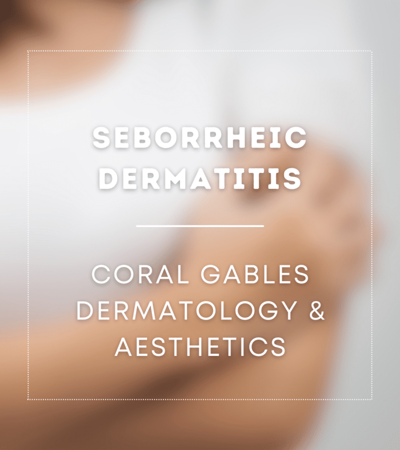 Seborrheic Dermatitis