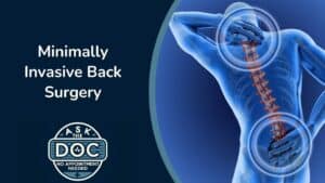 Transforming Back Pain: Minimally Invasive Surgery Explained