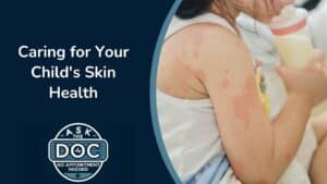 Skin Care Tips for Kids from Pediatrician