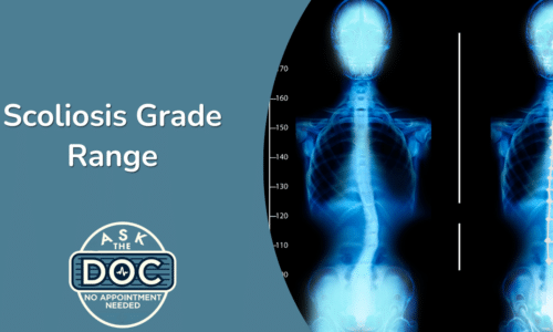 From Mild to Severe: Navigating the Scoliosis Grade Range
