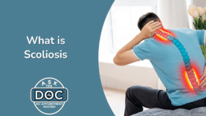Getting to Know Scoliosis: A Comprehensive Guide