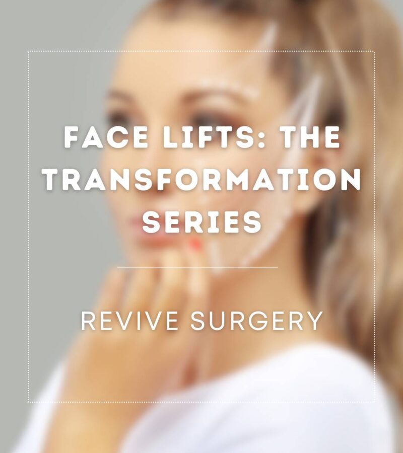 Face Lifts: The Transformation Series