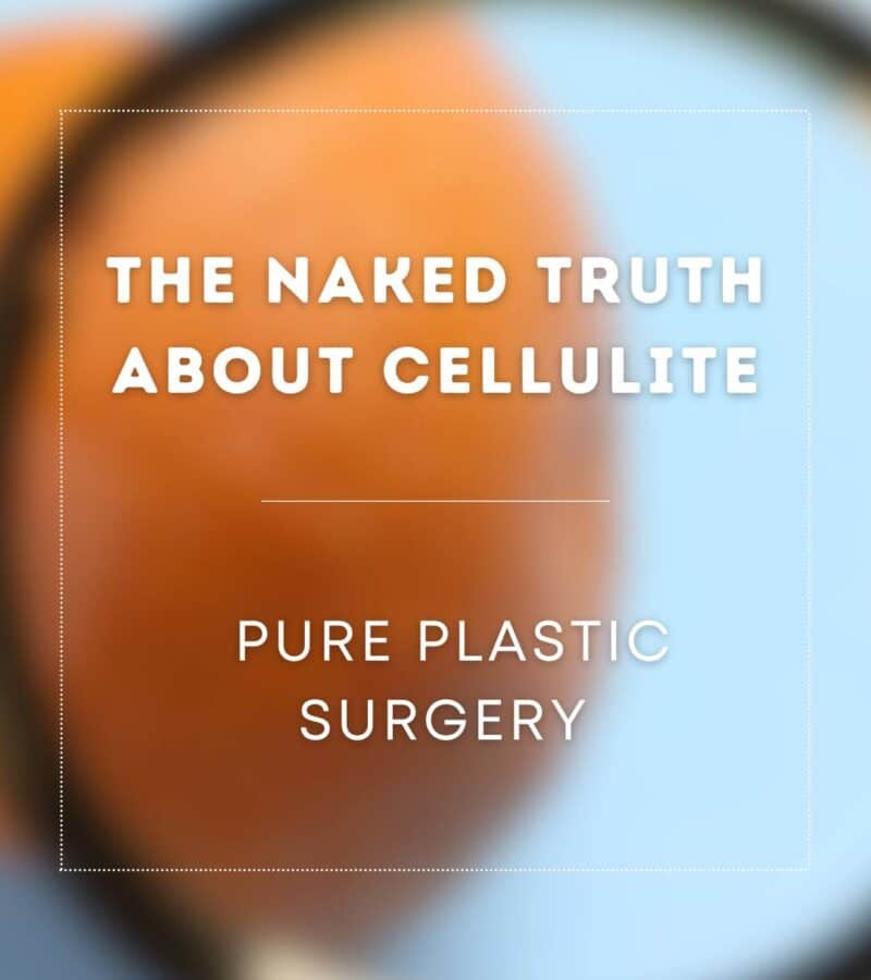 The Truth About Cellulite