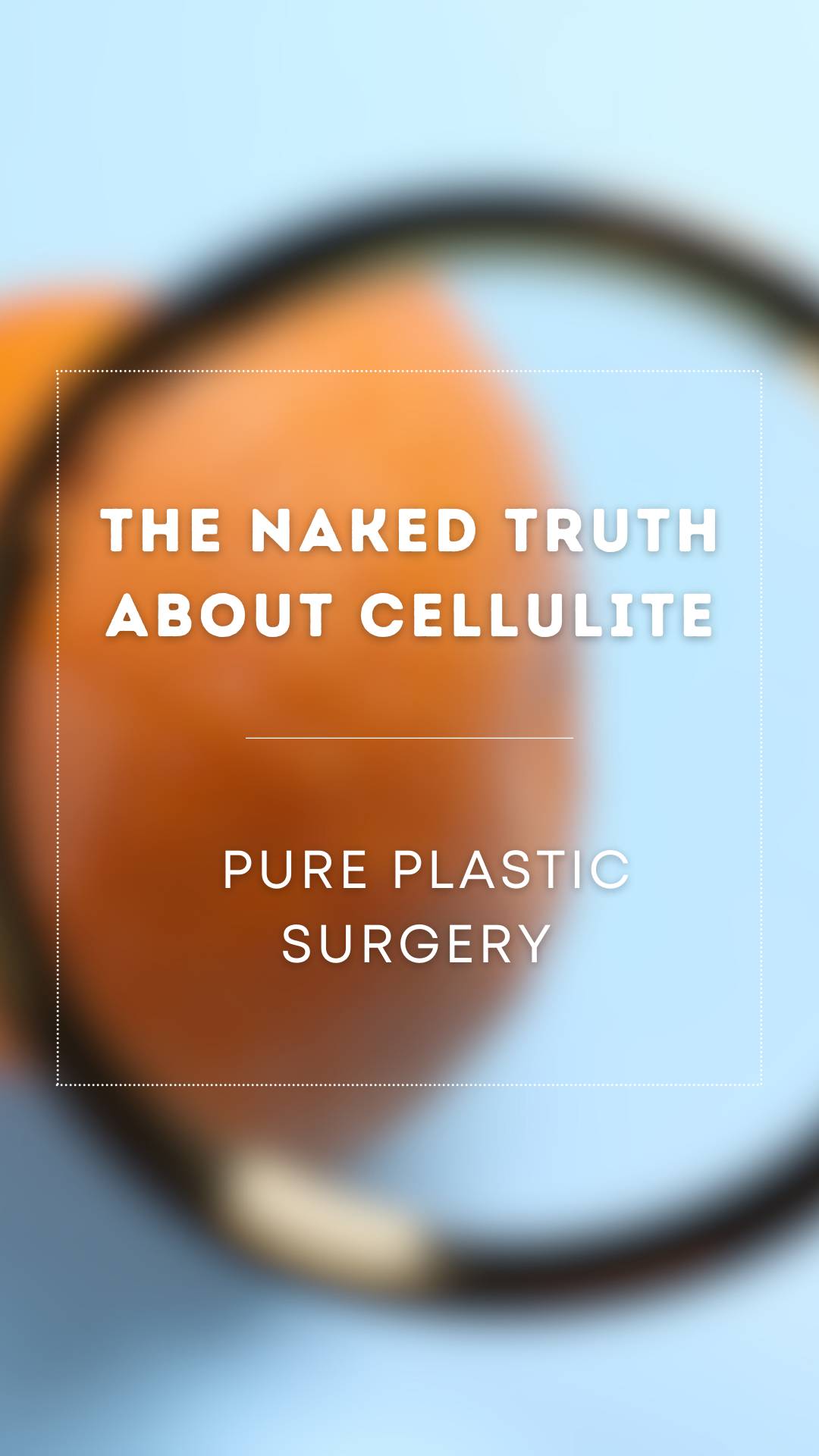 The Truth About Cellulite