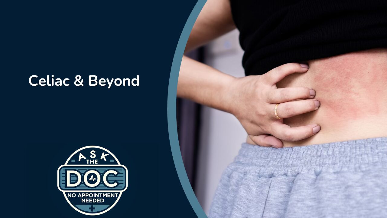 Autoimmune Diseases: Red Flags, Rashes, and Life with Celiac