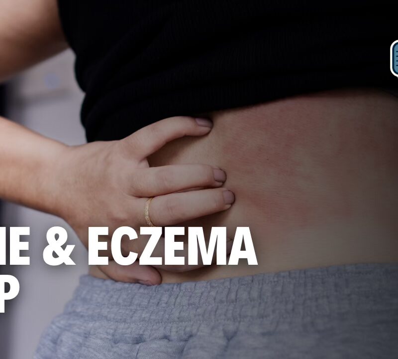 Healthy Skin, Expert Tips: Managing Skin Issues