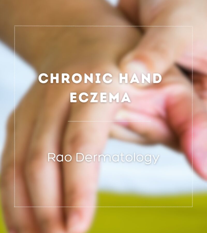 Chronic Hand Eczema: The Sleep–Skin–Mind Connection