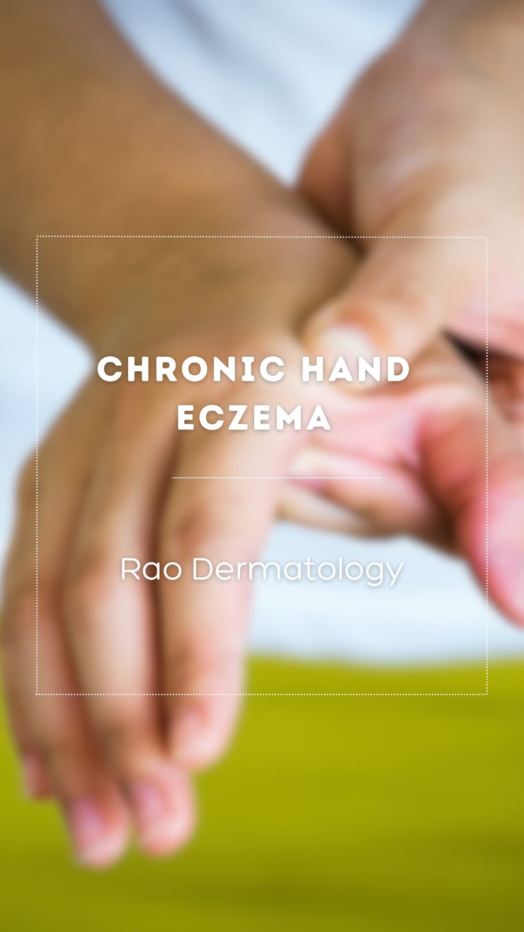 Chronic Hand Eczema: The Sleep–Skin–Mind Connection