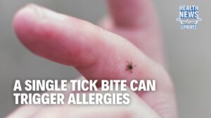 Can a Tick Bite Trigger an Allergy? Plus New Cancer Trends & DNA Weight Loss